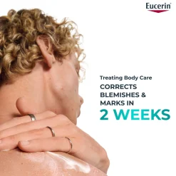 Eucerin DermoPure Clinical Correcting Body Cream 200ml Hot