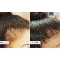 Hair Gain Gummies Trio - 3 Month Supply x 180 Gummies Outlet