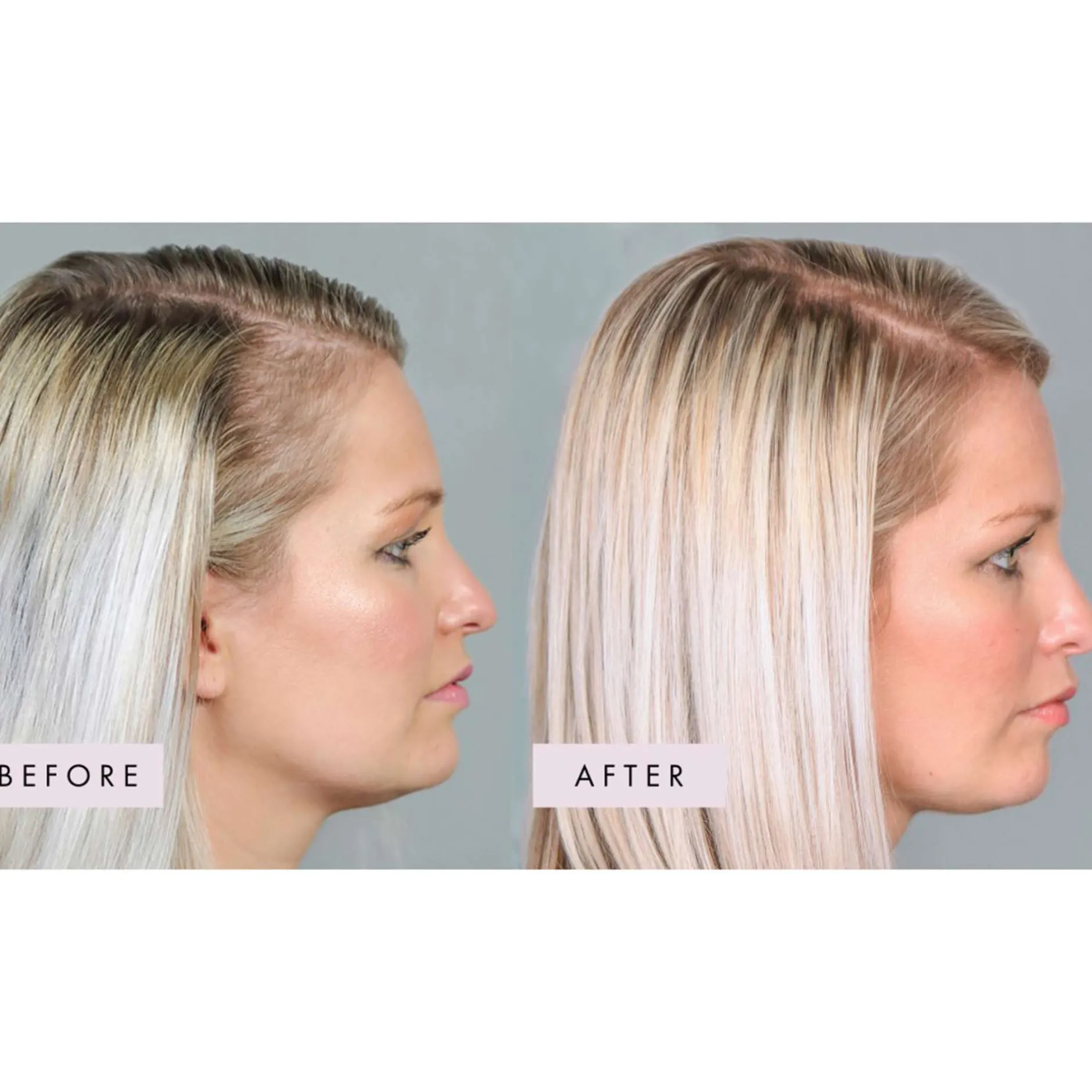 Hair Gain Hair Capsules 1 Month Supply x 60 Capsules Online