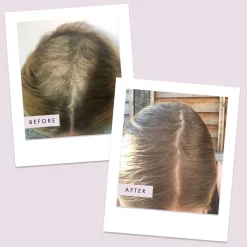 Hair Gain Hair Capsules Trio - 3 Month Supply x 180 Capsules Clearance