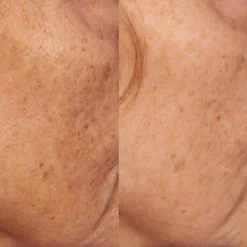 Perricone MD Treatments Vitamin C Ester Intensive Dark Spot Treatment 30ml Online